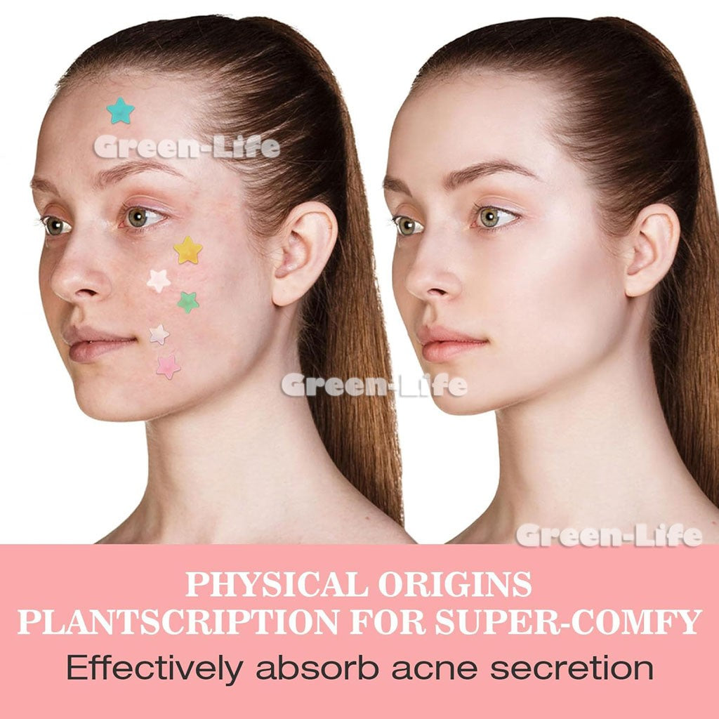 200 Pieces Acne Patch Tag Hydrocolloid Pimple Spot Acne Patch Plaster Pimple