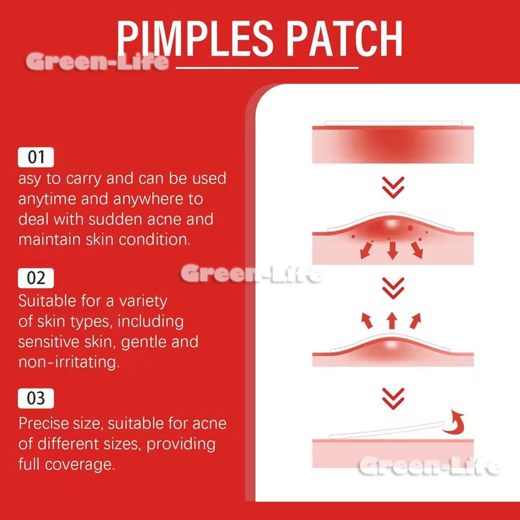 200 Pieces Acne Patch Tag Hydrocolloid Pimple Spot Acne Patch Plaster Pimple