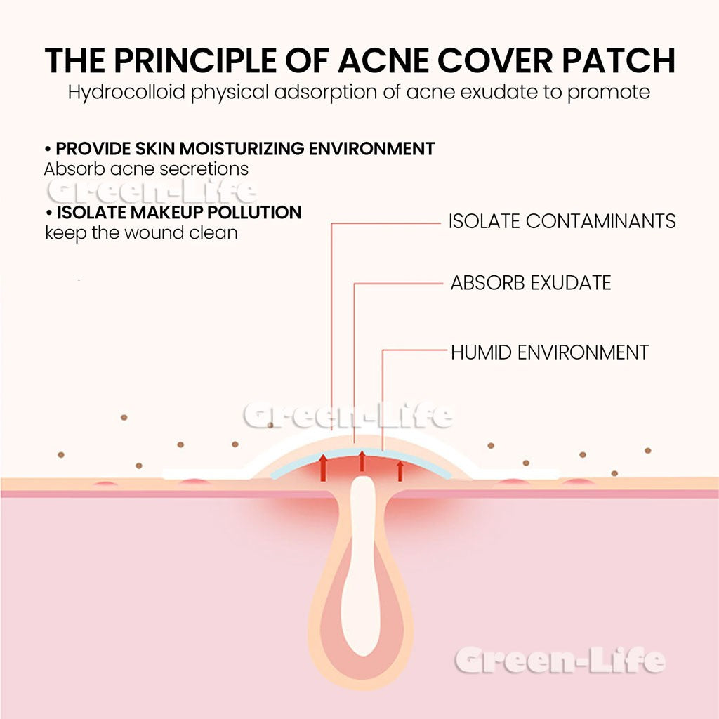 200 Pieces Acne Patch Tag Hydrocolloid Pimple Spot Acne Patch Plaster Pimple